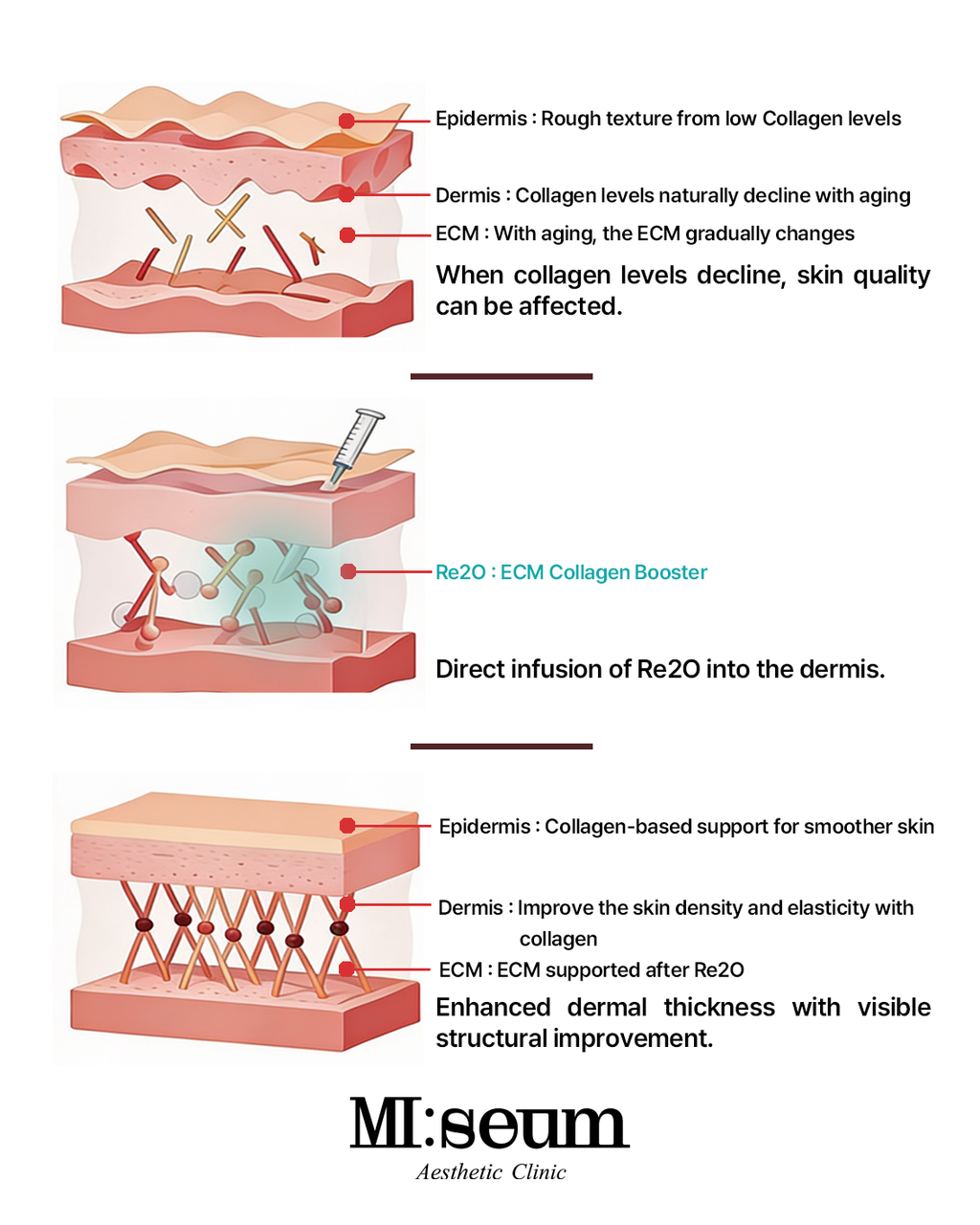 Re2O Extracellular Matrix(ECM) Collagen Booster
