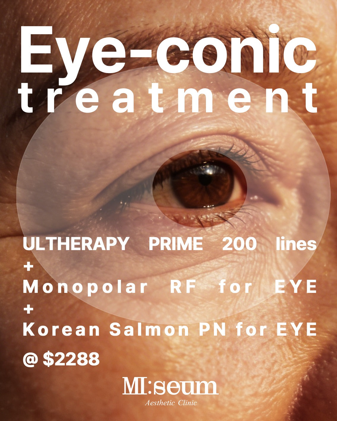 Eye-conic Treatment