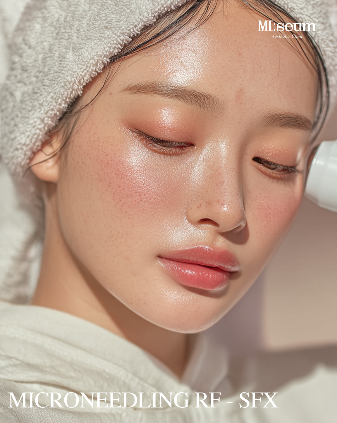 Microneedling RF - SFX