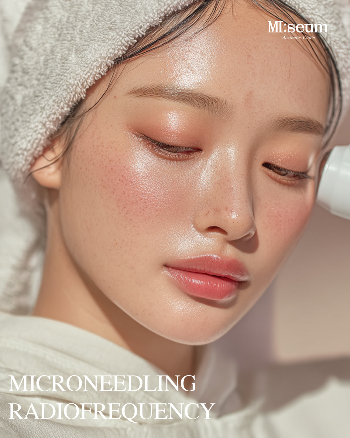 Microneedling Radiofrequency